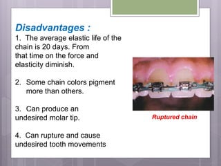 Disadvantages :
1. The average elastic life of the
chain is 20 days. From
that time on the force and
elasticity diminish.
2. Some chain colors pigment
more than others.
3. Can produce an
undesired molar tip.
4. Can rupture and cause
undesired tooth movements
Ruptured chain
 