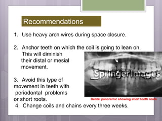 1. Use heavy arch wires during space closure.
2. Anchor teeth on which the coil is going to lean on.
This will diminish
their distal or mesial
movement.
3. Avoid this type of
movement in teeth with
periodontal problems
or short roots.
4. Change coils and chains every three weeks.
Recommendations
Dental panoramic showing short tooth roots
 