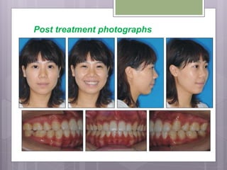 Post treatment photographs
 