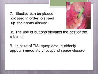 7. Elastics can be placed
crossed in order to speed
up the space closure.
8. The use of buttons elevates the cost of the
retainer.
9. In case of TMJ symptoms suddenly
appear immediately suspend space closure.
 