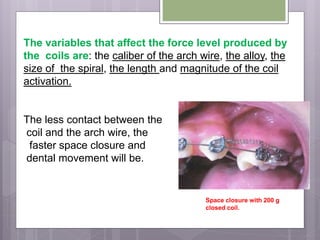 The variables that affect the force level produced by
the coils are: the caliber of the arch wire, the alloy, the
size of the spiral, the length and magnitude of the coil
activation.
The less contact between the
coil and the arch wire, the
faster space closure and
dental movement will be.
Space closure with 200 g
closed coil.
 