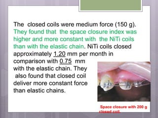 The closed coils were medium force (150 g).
They found that the space closure index was
higher and more constant with the NiTi coils
than with the elastic chain. NiTi coils closed
approximately 1.20 mm per month in
comparison with 0.75 mm
with the elastic chain. They
also found that closed coil
deliver more constant force
than elastic chains.
Space closure with 200 g
closed coil.
 