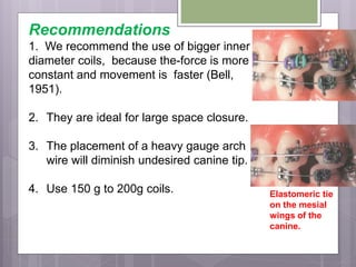 Recommendations
1. We recommend the use of bigger inner
diameter coils, because the-force is more
constant and movement is faster (Bell,
1951).
2. They are ideal for large space closure.
3. The placement of a heavy gauge arch
wire will diminish undesired canine tip.
4. Use 150 g to 200g coils. Elastomeric tie
on the mesial
wings of the
canine.
 