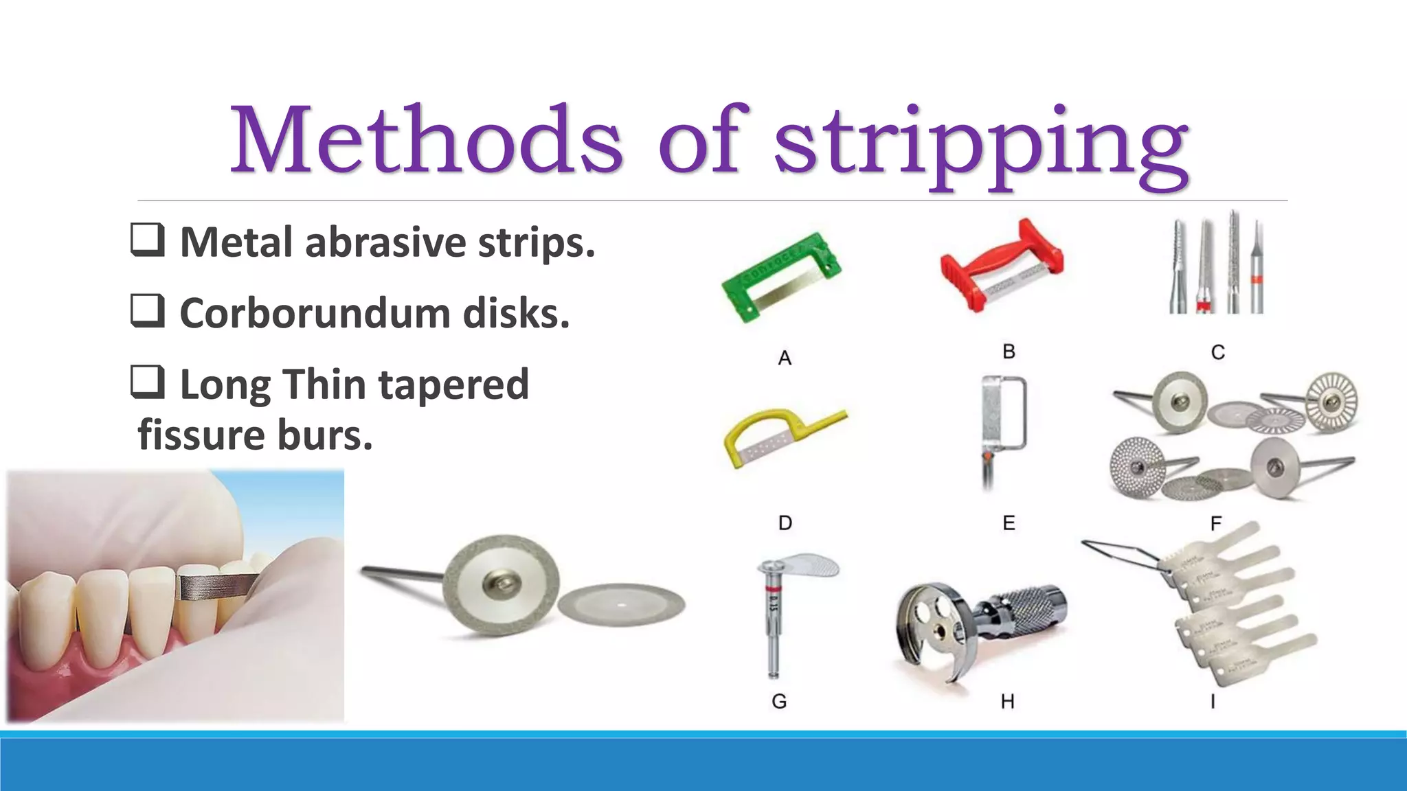 Methods of stripping
 Metal abrasive strips.
 Corborundum disks.
 Long Thin tapered
fissure burs.
 