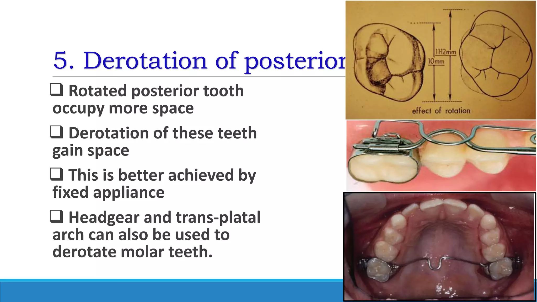 5. Derotation of posterior teeth
 Rotated posterior tooth
occupy more space
 Derotation of these teeth
gain space
 This is better achieved by
fixed appliance
 Headgear and trans-platal
arch can also be used to
derotate molar teeth.
 