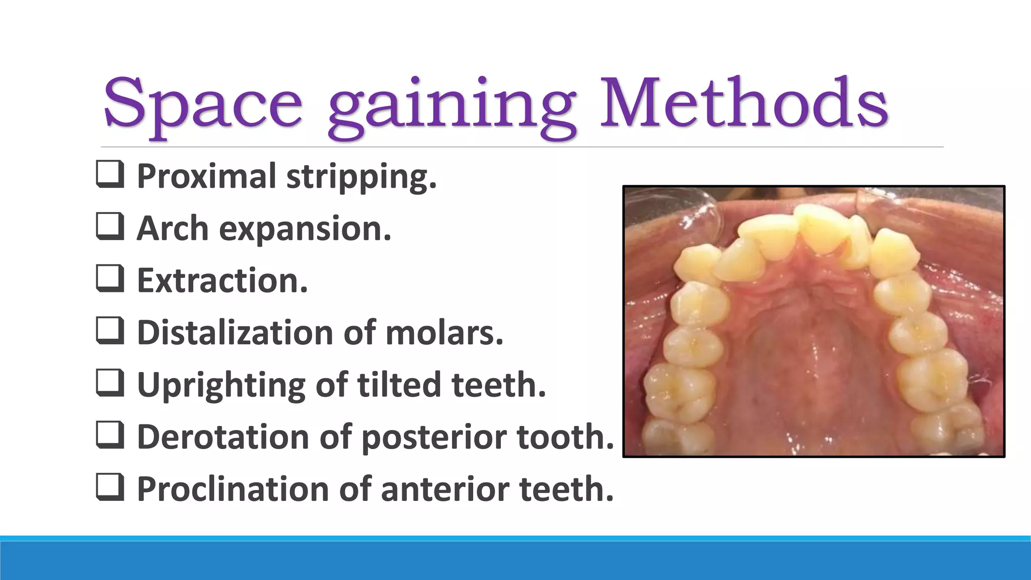 Space gaining Methods
 Proximal stripping.
 Arch expansion.
 Extraction.
 Distalization of molars.
 Uprighting of tilted teeth.
 Derotation of posterior tooth.
 Proclination of anterior teeth.
 