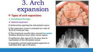 3. Arch
expansion
 Types of arch expansions
1. According to the type:
A. Skeletal expansion:
 Achieved by opening the mid-palatal suture.
 The expansion screw is activated at a rate of
(0.25-0.5 mm) per day.
 The treatment usually takes around two weeks
(midline diastema occur when suture open).
 Ineffective after age of 15-16 years due to
ossification of the mid-platal suture
 Surgically assisted rapid palatal expansion is
indicated after age of 16 years.
 