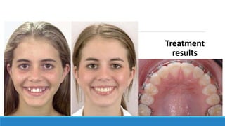 Treatment
results
 