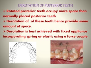 Space gaining methods -ORTHODONTICS | PPTX