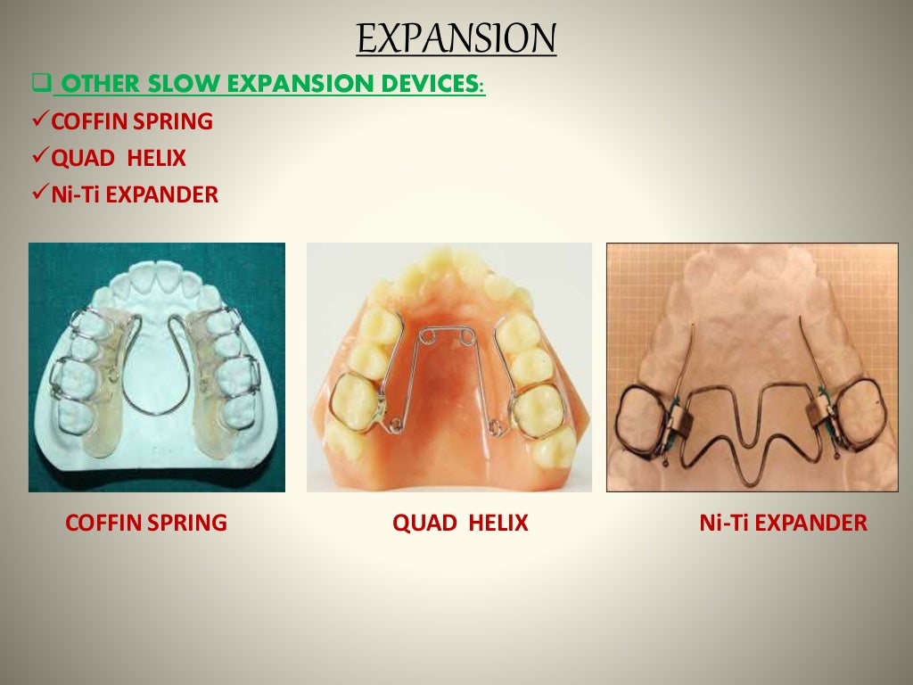 Space gaining methods ORTHODONTICS