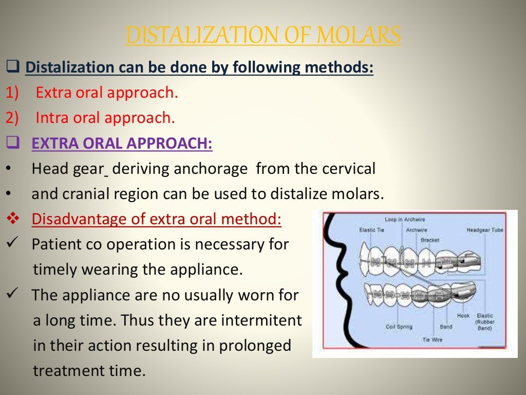Space gaining methods ORTHODONTICS