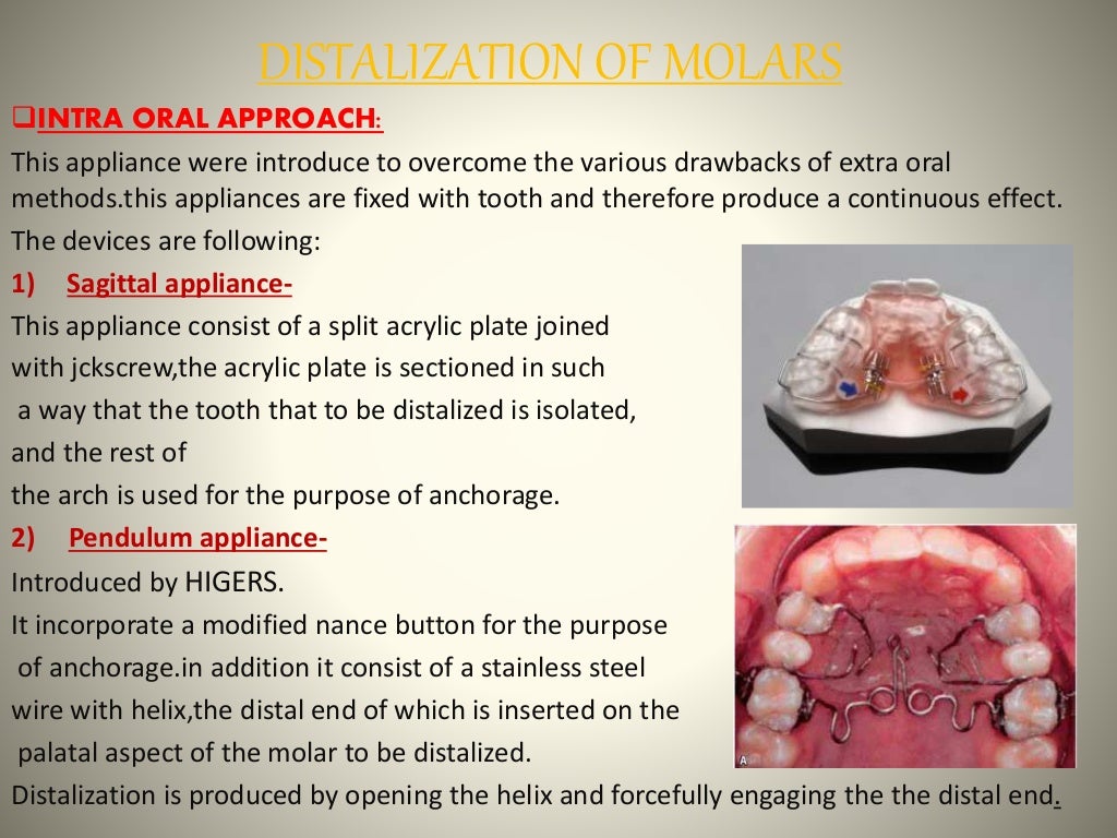 Space gaining methods ORTHODONTICS