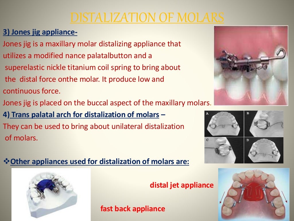 Space gaining methods ORTHODONTICS