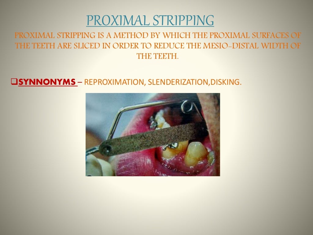 Space gaining methods ORTHODONTICS