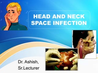 HEAD AND NECK
SPACE INFECTION
Dr. Ashish,
Sr.Lecturer
 