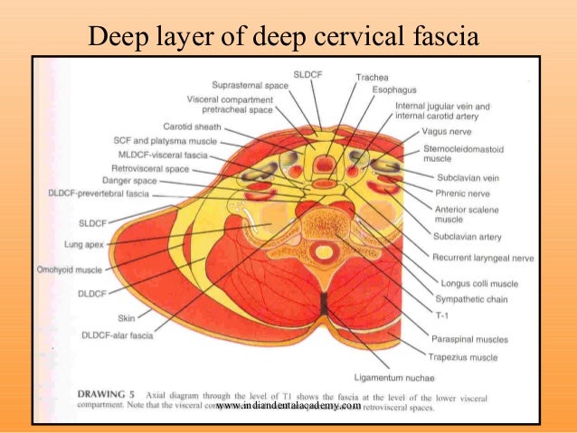 Space infection /certified fixed orthodontic courses by ... diagram of neck lift surgery 