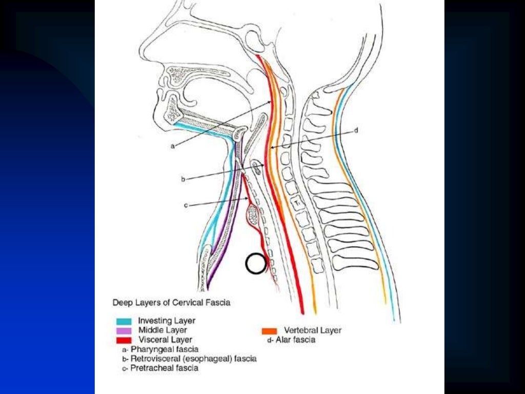 Fascial Space infection