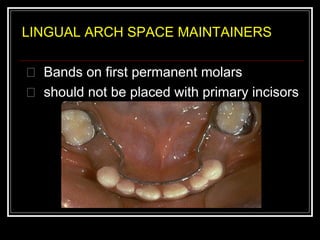 LINGUAL ARCH SPACE MAINTAINERS

 Bands on first permanent molars
 should not be placed with primary incisors
 