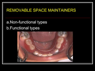 REMOVABLE SPACE MAINTAINERS

a.Non-functional types
b.Functional types
 