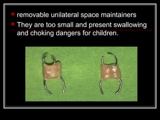    removable unilateral space maintainers
   They are too small and present swallowing
    and choking dangers for children.
 