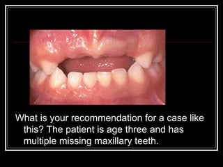 What is your recommendation for a case like
 this? The patient is age three and has
 multiple missing maxillary teeth.
 