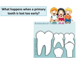 What happens when a primary
tooth is lost too early?
 