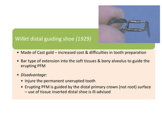 Willet distal guiding shoe (1929)
• Made of Cast gold – increased cost & difficulties in tooth preparation
• Bar type of extension into the soft tissues & bony alveolus to guide the
erupting PFM
• Disadvantage:
• Injure the permanent unerupted tooth
• Erupting PFM is guided by the distal primary crown (not root) surface
– use of tissue inserted distal shoe is ill-advised
 