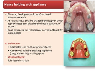 • Bilateral, fixed, passive & non-functional
space maintainer
• At rugae area, a small U-shaped bend is given which
approximates 1cm distal to the lingual surfaces of
incisors
• Bend enhances the retention of acrylic button (0.5”
in diameter)
• Indications
• Bilateral loss of multiple primary teeth
• Also serves as habit breaking appliance
(tongue thrusting) – using spurs
• Disadvantages:
Soft tissue irritation
Nance holding arch appliance
 