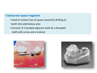 • Jackscrew space regainer
• Used to recover loss of space caused by drifting of
tooth into edentulous area
• Consists of 2 banded adjacent teeth & a threaded
shaft with screw and a locknut
 