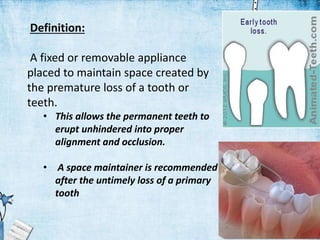 Definition:
A fixed or removable appliance
placed to maintain space created by
the premature loss of a tooth or
teeth.
• This allows the permanent teeth to
erupt unhindered into proper
alignment and occlusion.
• A space maintainer is recommended
after the untimely loss of a primary
tooth
 