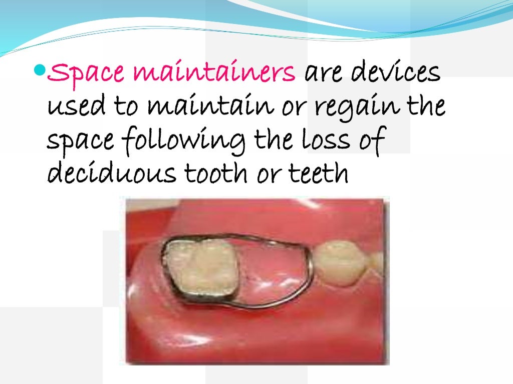 Space maintainers