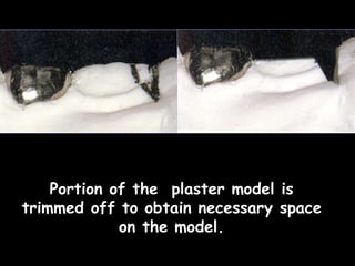 Portion of the plaster model is
trimmed off to obtain necessary space
on the model.
 