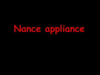 Nance appliance
 
