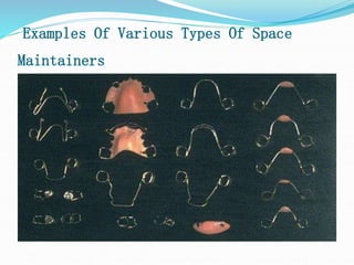 Examples Of Various Types Of Space
Maintainers
 