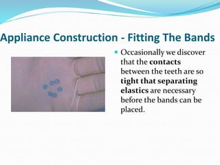 Appliance Construction - Fitting The Bands
 Occasionally we discover
that the contacts
between the teeth are so
tight that separating
elastics are necessary
before the bands can be
placed.
 