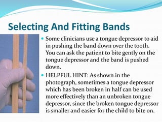 Selecting And Fitting Bands
 Some clinicians use a tongue depressor to aid
in pushing the band down over the tooth.
You can ask the patient to bite gently on the
tongue depressor and the band is pushed
down.
 HELPFUL HINT: As shown in the
photograph, sometimes a tongue depressor
which has been broken in half can be used
more effectively than an unbroken tongue
depressor, since the broken tongue depressor
is smaller and easier for the child to bite on.
 