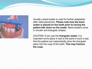 Usually a band seater is used for further adaptation
after initial placement. Please note how the band
seater is placed on the tooth prior to having the
patient bite down on the seater. Band seaters come
in circular and triangular shapes.
CAUTION: If you use the triangular seater, it is
important not to place it next to the band in such a way
that the patient can inadvertently drive the triangular
piece into the cusp of the tooth. This may fracture
the cusp.
 