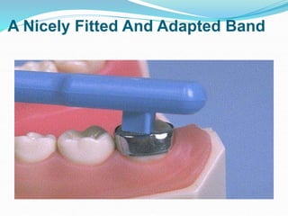 A Nicely Fitted And Adapted Band
 