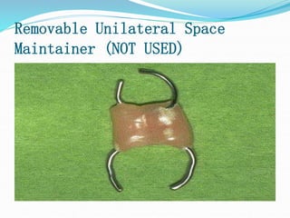 Removable Unilateral Space
Maintainer (NOT USED)
 