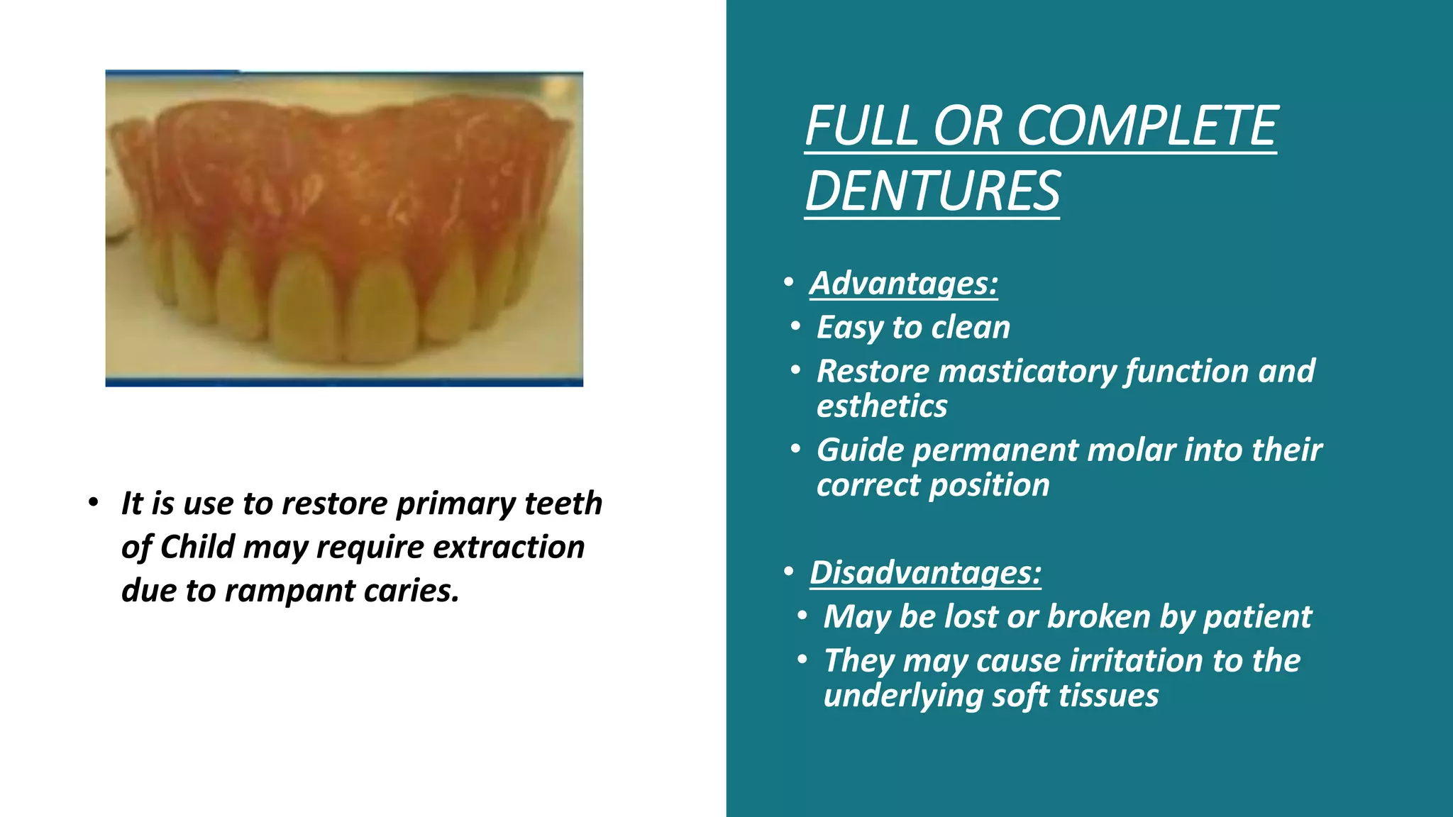 Fixed and Removable Space maintainers in orthodontics PPT