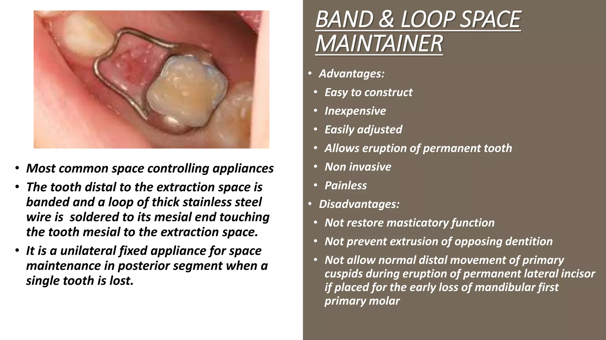 Fixed and Removable Space maintainers in orthodontics PPT
