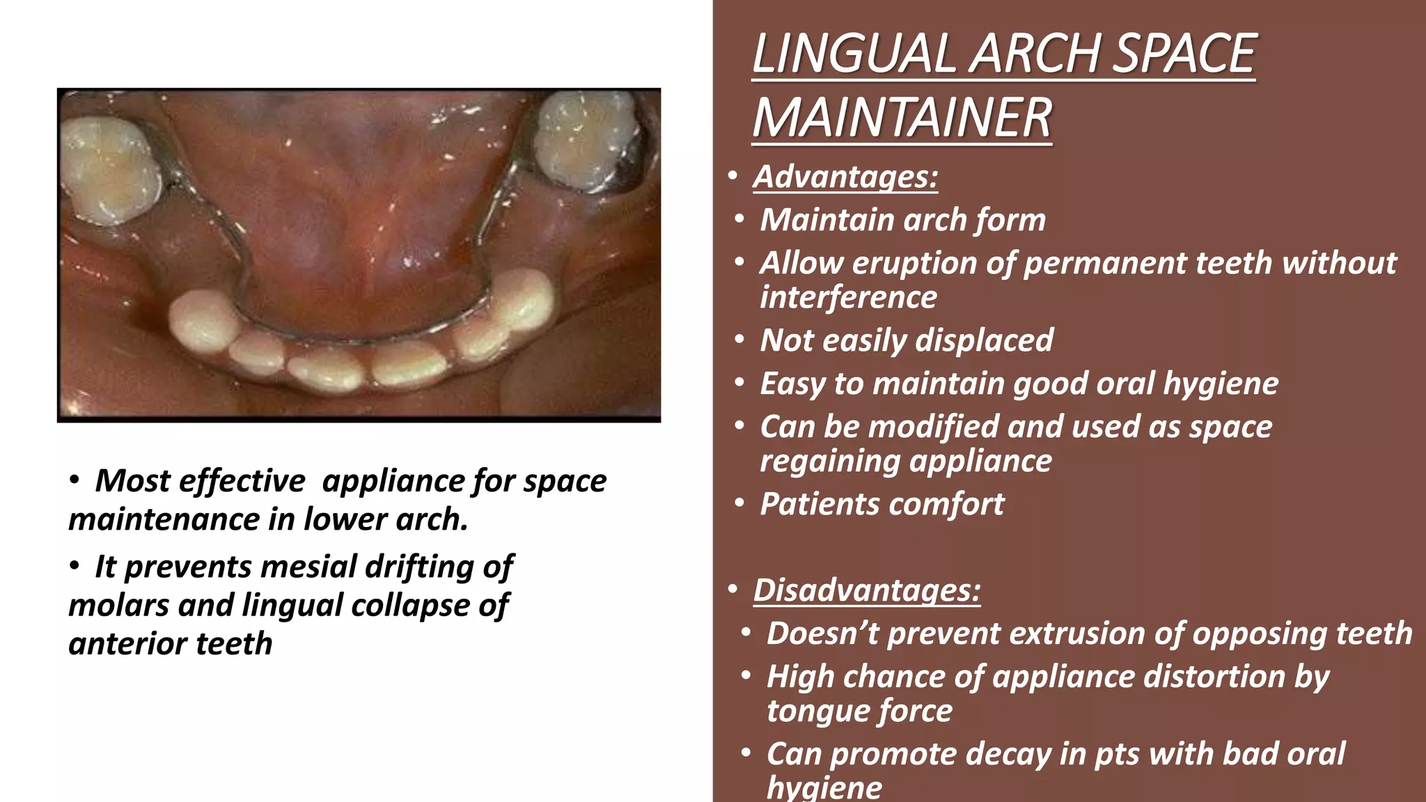 Fixed and Removable Space maintainers in orthodontics PPT