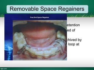 Removable Space Regainers
• Free end loop Space regainer:
– Labial arch wire for stability and retention
– Back action loop spring constructed of
No:0.025 wire
– Movement of permanent molar achived by
activating the free end of the wire loop at
specific intervals of time
 