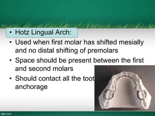 • Hotz Lingual Arch:
• Used when first molar has shifted mesially
and no distal shifting of premolars
• Space should be present between the first
and second molars
• Should contact all the tooth for better
anchorage
 