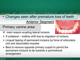 • Changes seen after premature loss of teeth
Anterior Segment
Primary canine area:
 main reason erupting lateral incisors
 If unilateral – midline shift due to migration of incisors
 Lingual tipping of permanent incisors by force of orbicularis
oris and associated muscles
 Best to remove opposite primary cuspid to permit the
permanent incisors to tip towards a symmetrical
arrangement
 