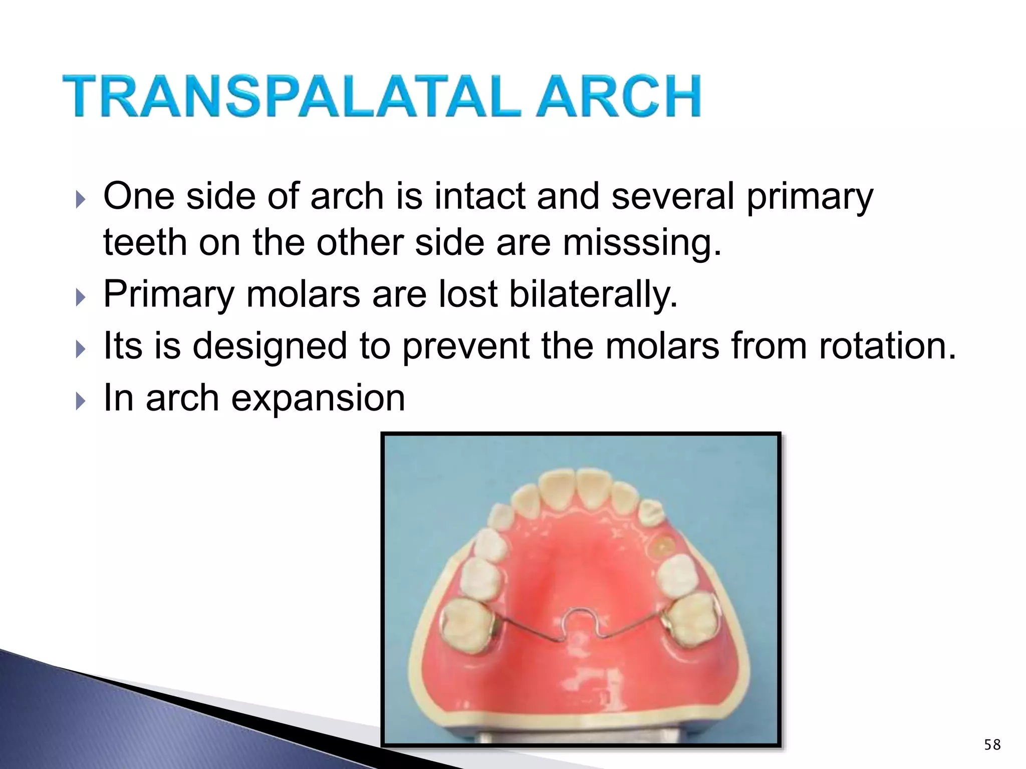  One side of arch is intact and several primary
teeth on the other side are misssing.
 Primary molars are lost bilaterally.
 Its is designed to prevent the molars from rotation.
 In arch expansion
58
 