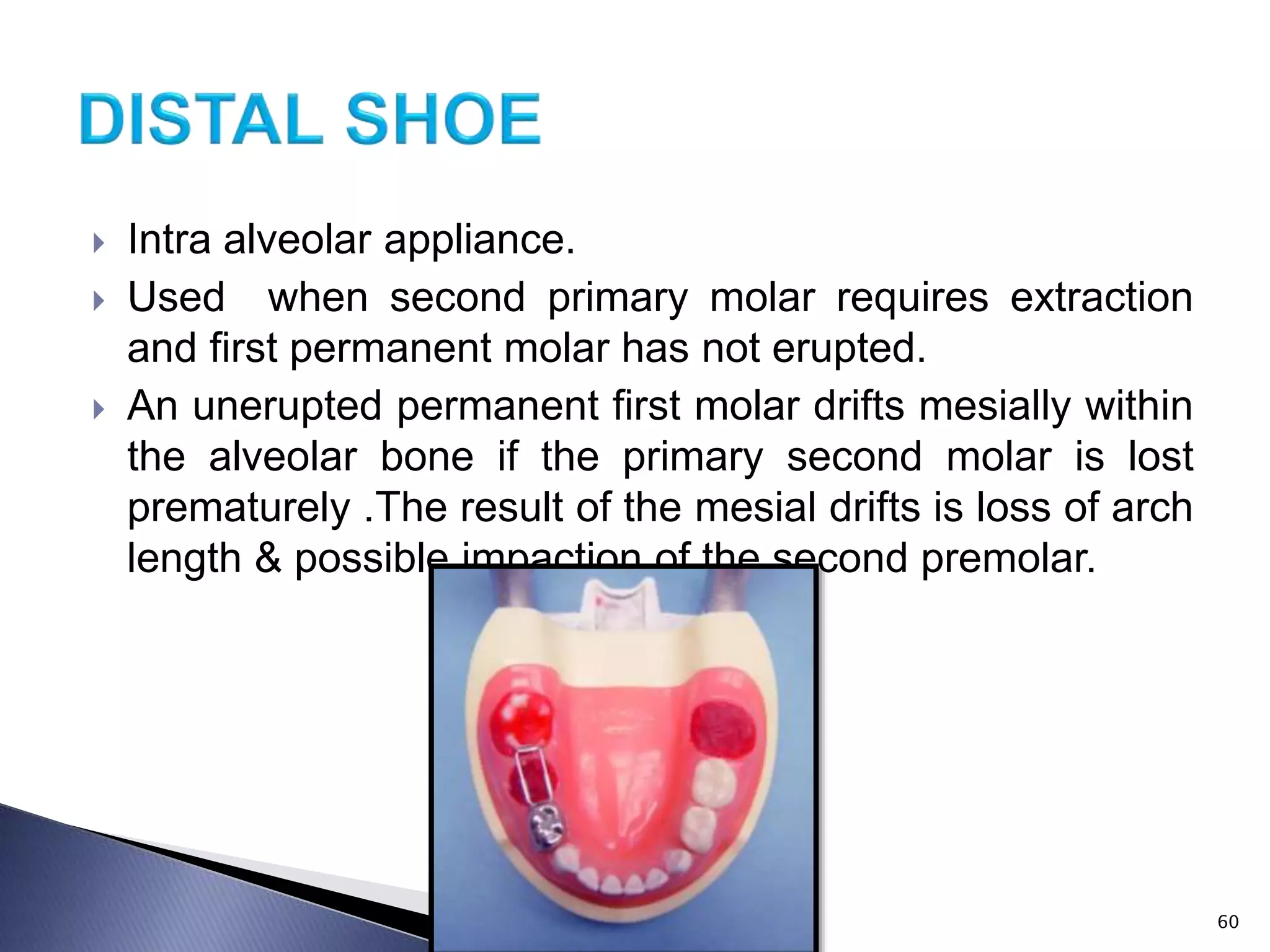 Intra alveolar appliance.
 Used when second primary molar requires extraction
and first permanent molar has not erupted.
 An unerupted permanent first molar drifts mesially within
the alveolar bone if the primary second molar is lost
prematurely .The result of the mesial drifts is loss of arch
length & possible impaction of the second premolar.
60
 