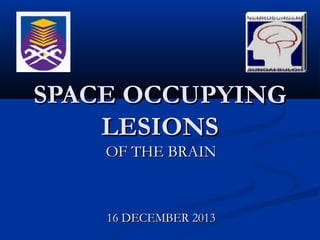SPACE OCCUPYING
LESIONS
OF THE BRAIN

16 DECEMBER 2013

 