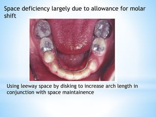 Space deficiency largely due to allowance for molar
shift
Using leeway space by disking to increase arch length in
conjunction with space maintainence
 