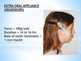 EXTRA ORAL APPLIANCE
(HEADGEARS)
Force = 100g/side
Duration = 14 to 16 hrs
Rate of tooth movement =
1 mm/month
 